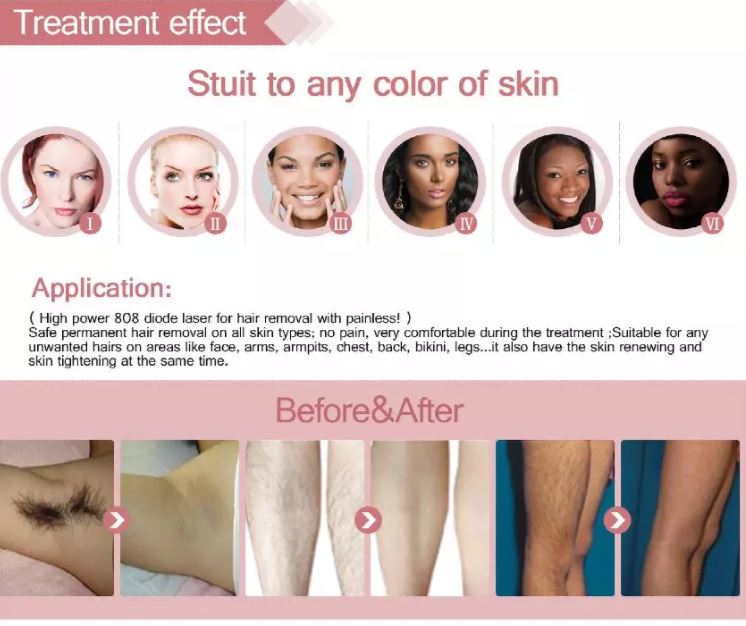 Professional Diode Laser All Colors Hair Removal Machine Professional Diode Laser All Colors Hair Removal Machine